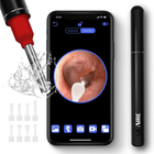 AIRE™ Ear Wax Removal Kit with 1080P FHD Wi-Fi Ear Camera product image