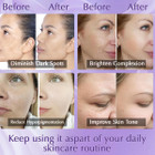 Dark Spot Remover for Face product image