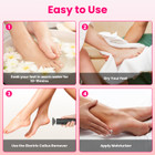 2-In-1 Electric Foot Callus Remover & Nail Grinder product image