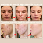 Light Therapy Pro LED Face Mask product image