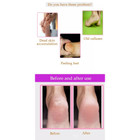 Smooth Heels Electric Callus Remover product image