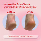 Onyx Professional Cracked Heel Treatment (2-Pack) product image