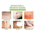 Multipurpose Silicone Scar Sheet for Scar Removal product image