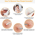 5-Piece Skincare Blackhead Remover Kit product image