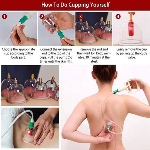 iNova™ 32-Cup Alternative Medicine Cupping Therapy Set product image