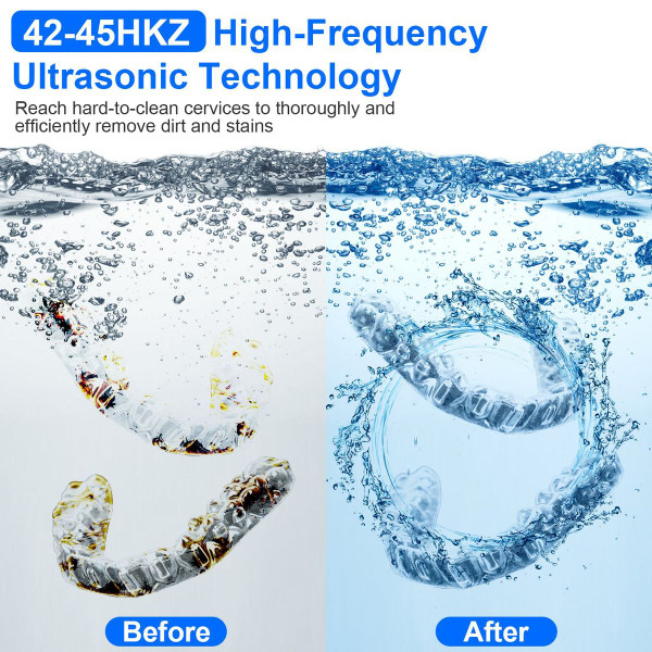 Sonic Dental Cleaning Machine product image