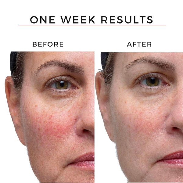 Anti-Aging Silk Facial Serum  product image
