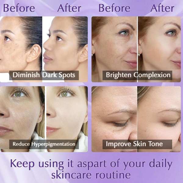 Dark Spot Remover for Face product image