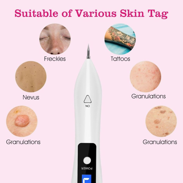 Electronic Ion Skin Tag Repair Kit with 9 Intensity Levels product image