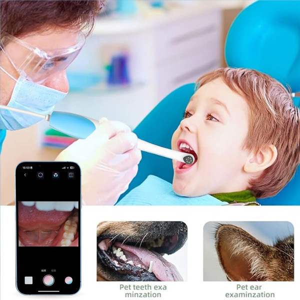 1920P HD Oral Endoscope product image