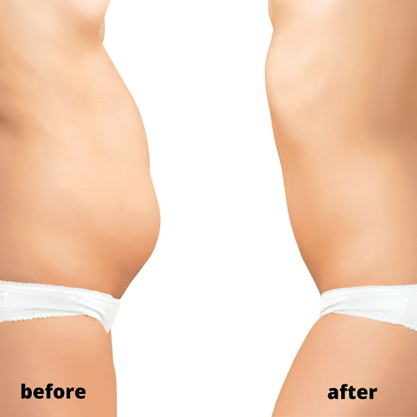 Collections Etc Non-Invasive Cordless Cryoshaper product image