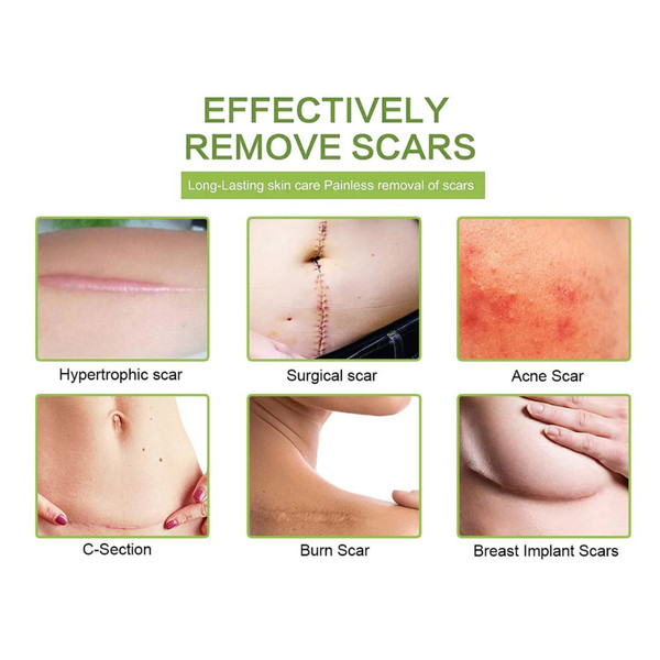 Multipurpose Silicone Scar Sheet for Scar Removal product image