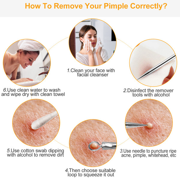 5-Piece Skincare Blackhead Remover Kit product image