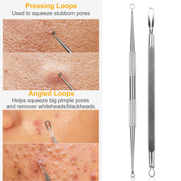 5-Piece Skincare Blackhead Remover Kit product image