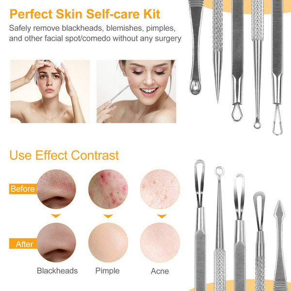 5-Piece Skincare Blackhead Remover Kit product image