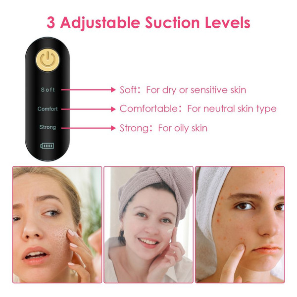 iMounTEK Vacuum Acne Remover product image
