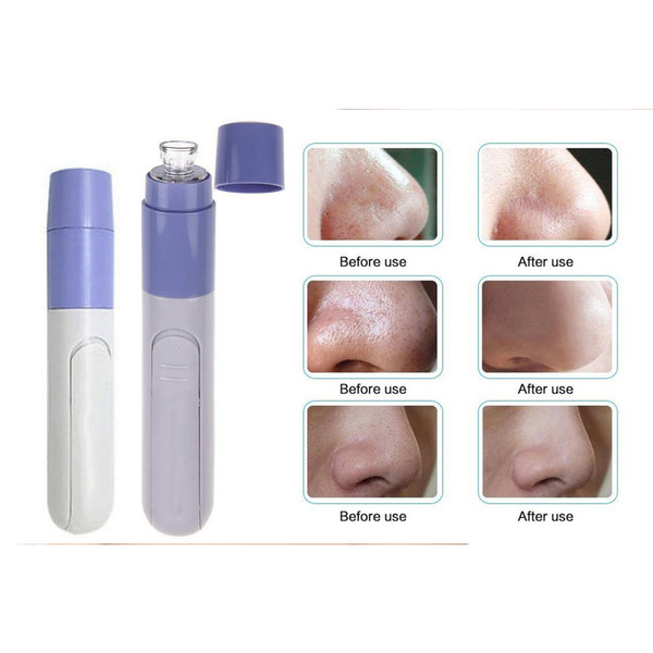 Anti-Aging Skin Care Smoothing Facial Massager and Pore Cleanser product image