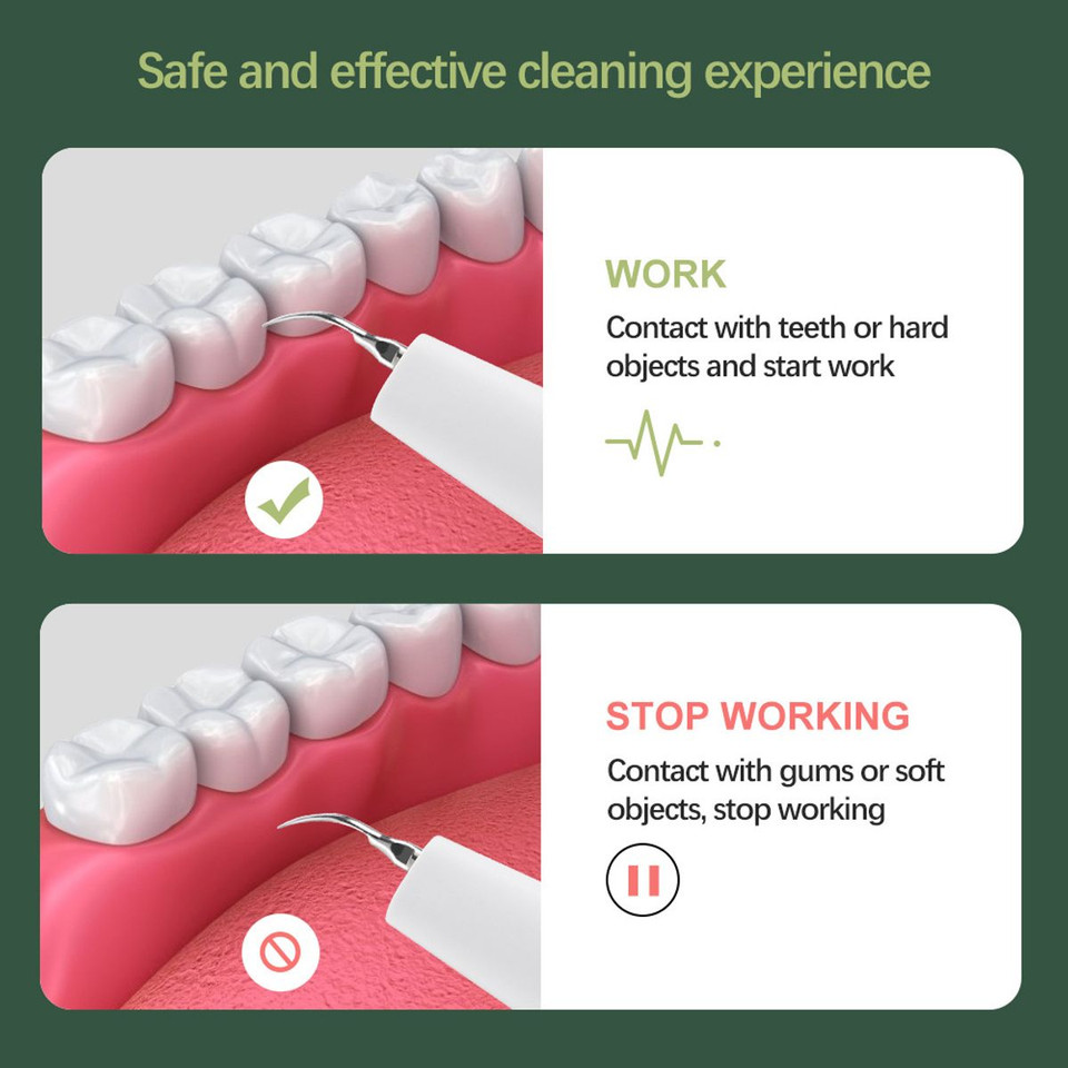 Electric Ultrasonic Dental Scaler Calculus Oral Tartar Remover Tooth Stain Cleaner Teeth Cleaner Plaque Remover product image