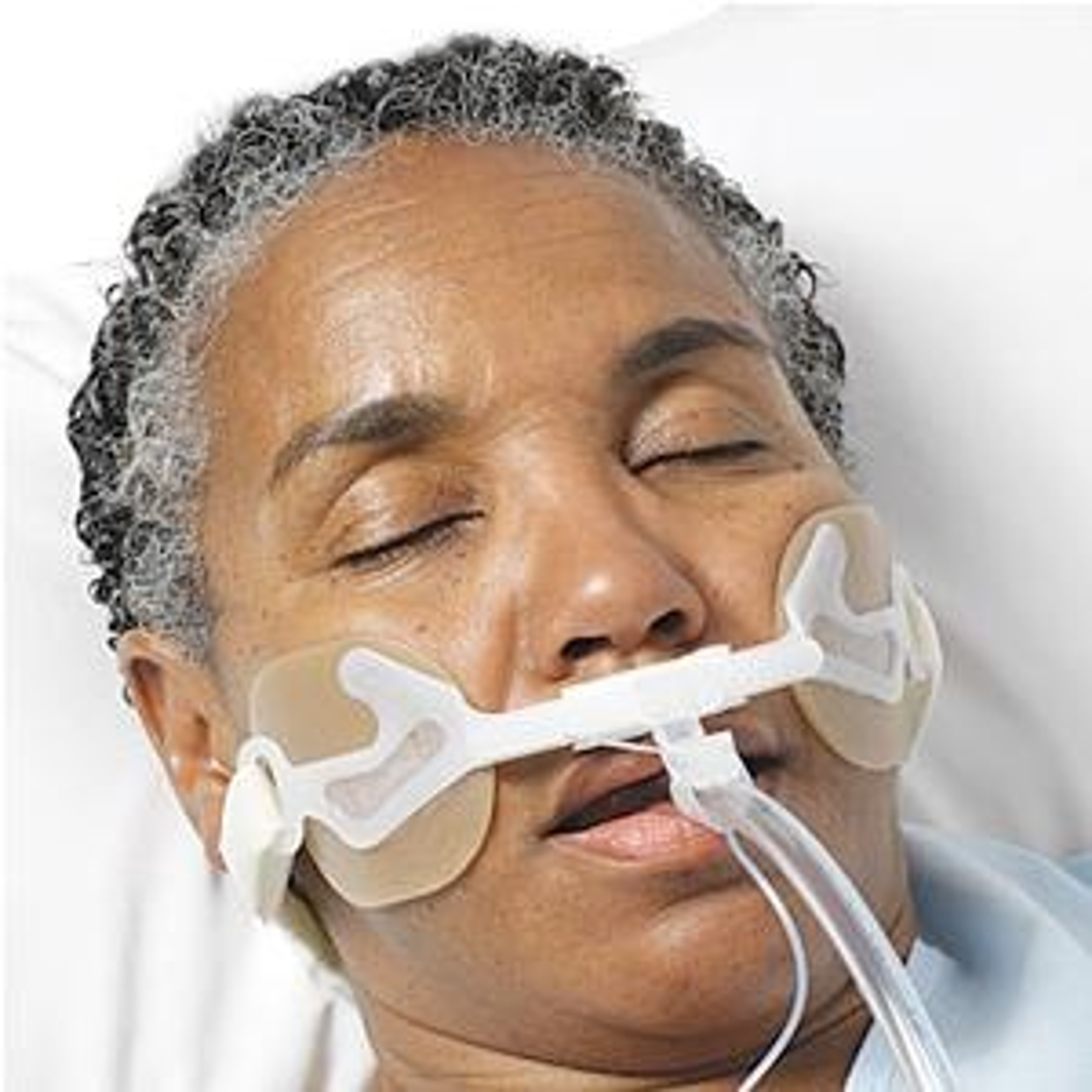 Hollister AnchorFast Oral Endotracheal Tube Fastener