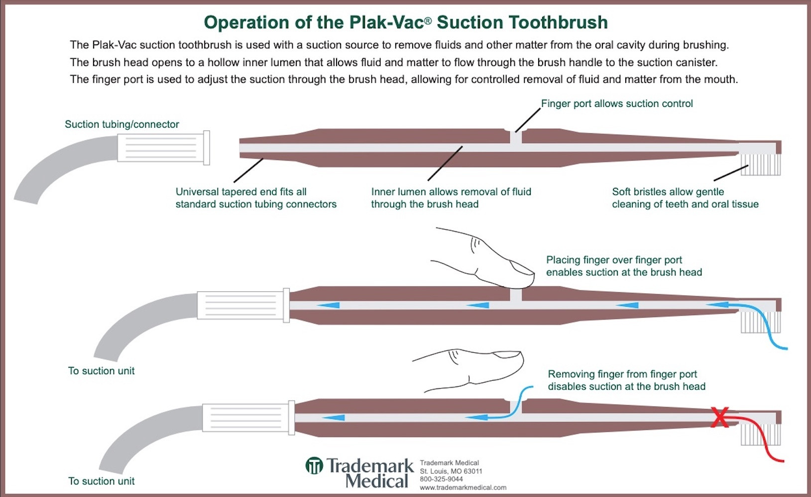 Plak-Vac Suction Toothbrush