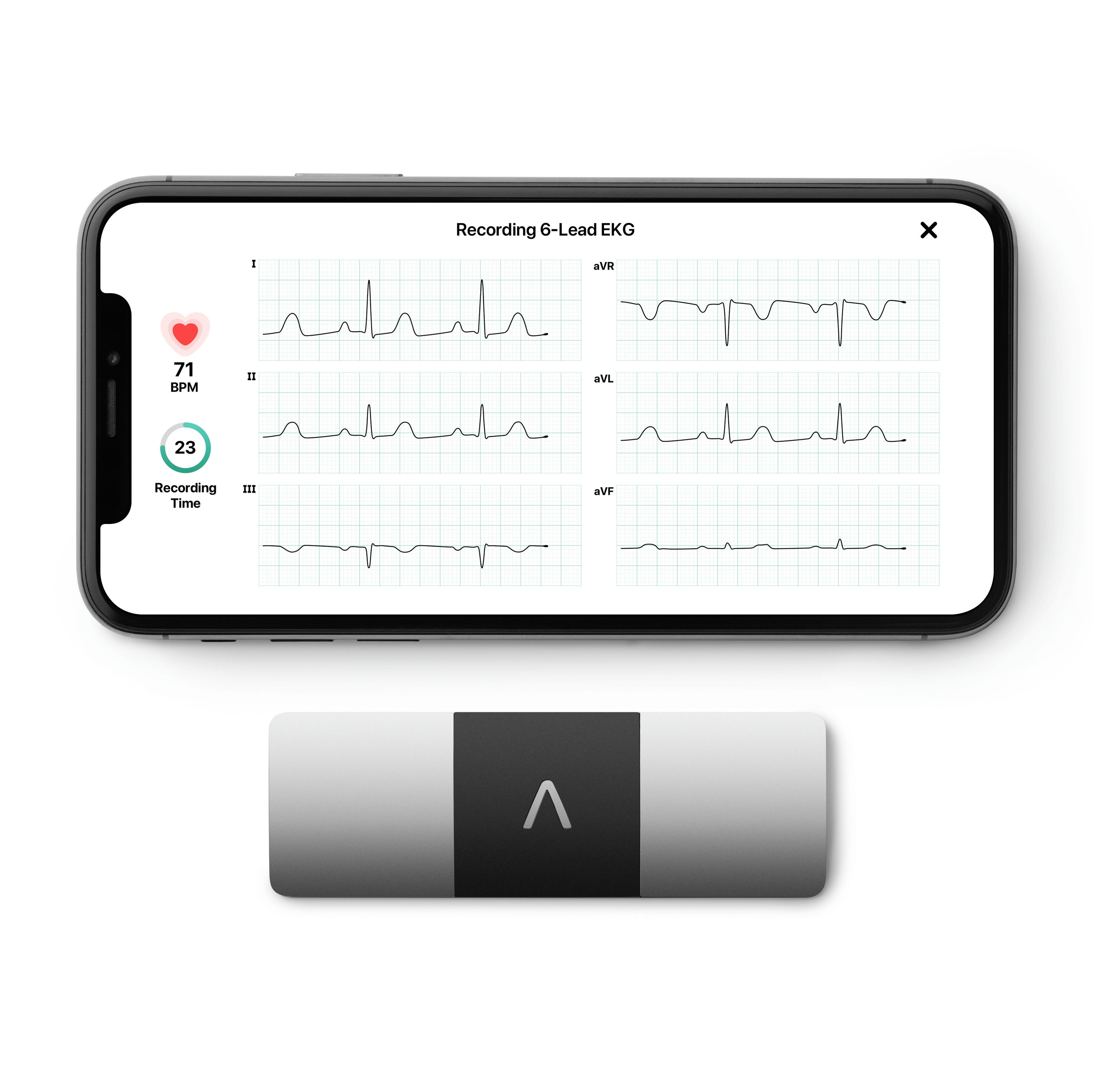 AliveCor KardiaMobile 6L