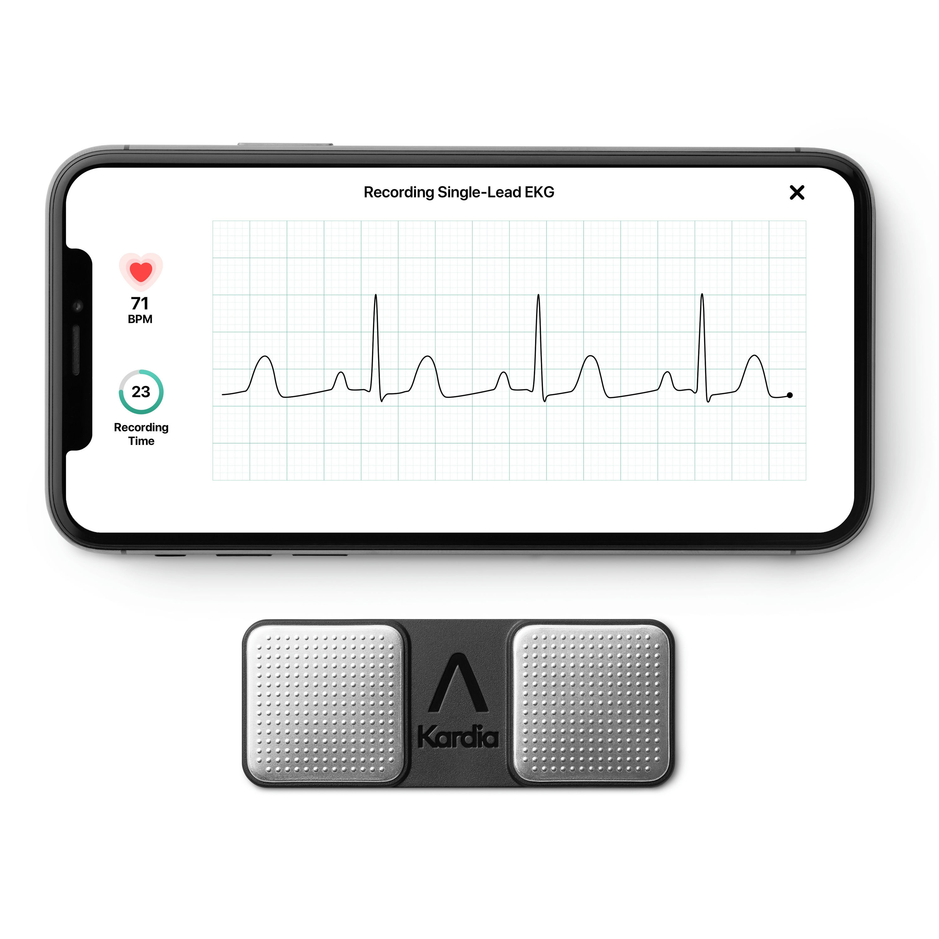 AliveCor KardiaMobile