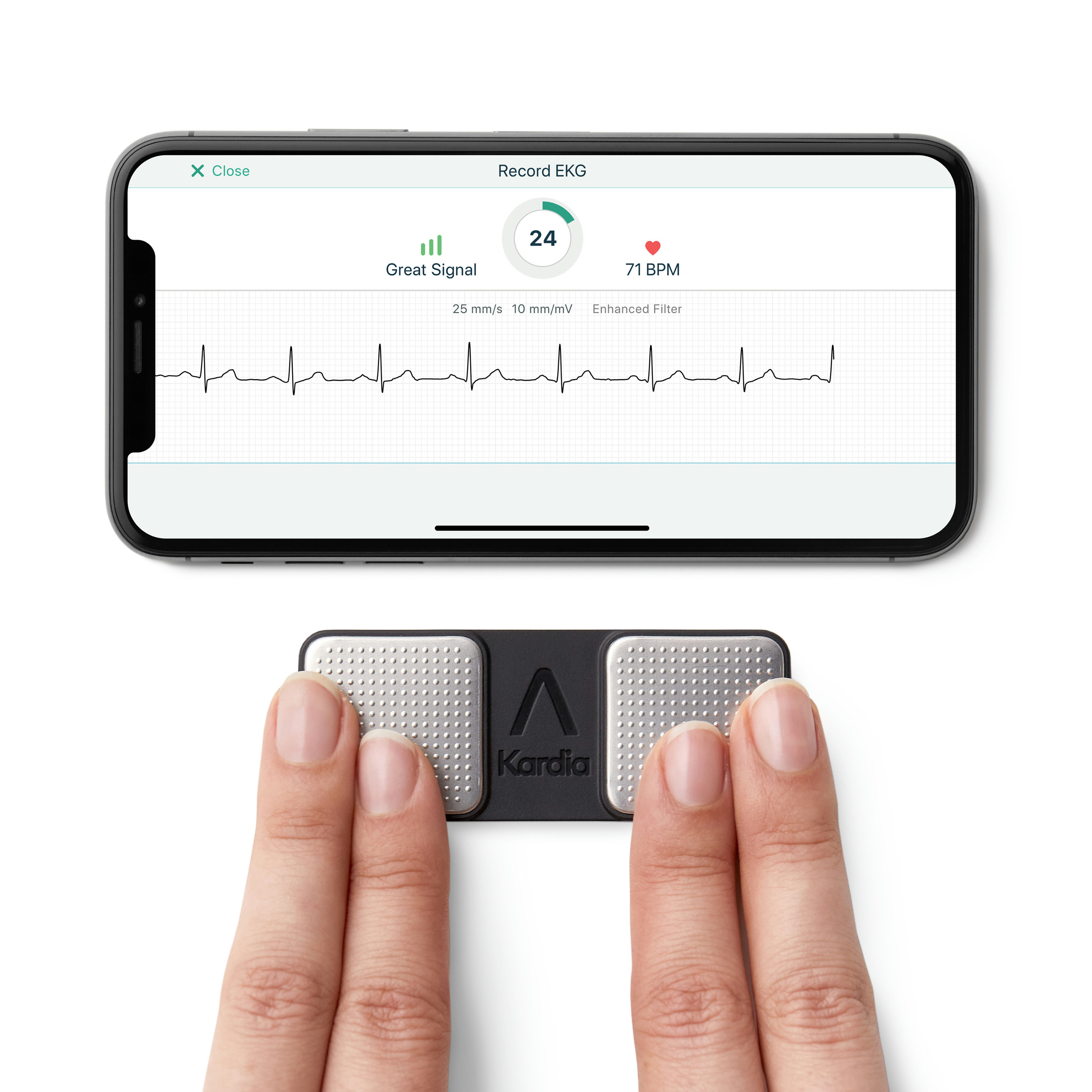 AliveCor KardiaMobile