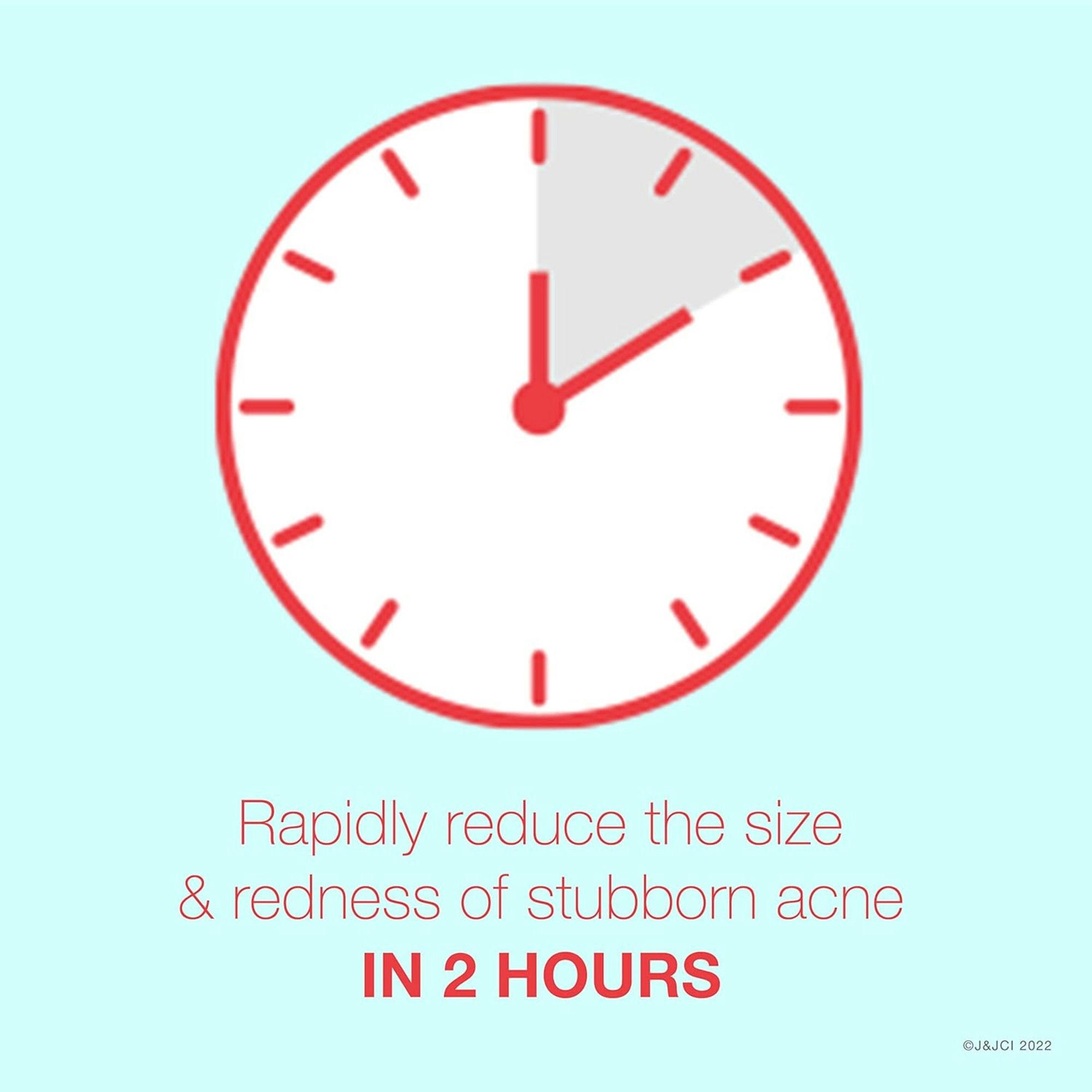 Neutrogena Rapid Clear Stubborn Acne Spot Gel