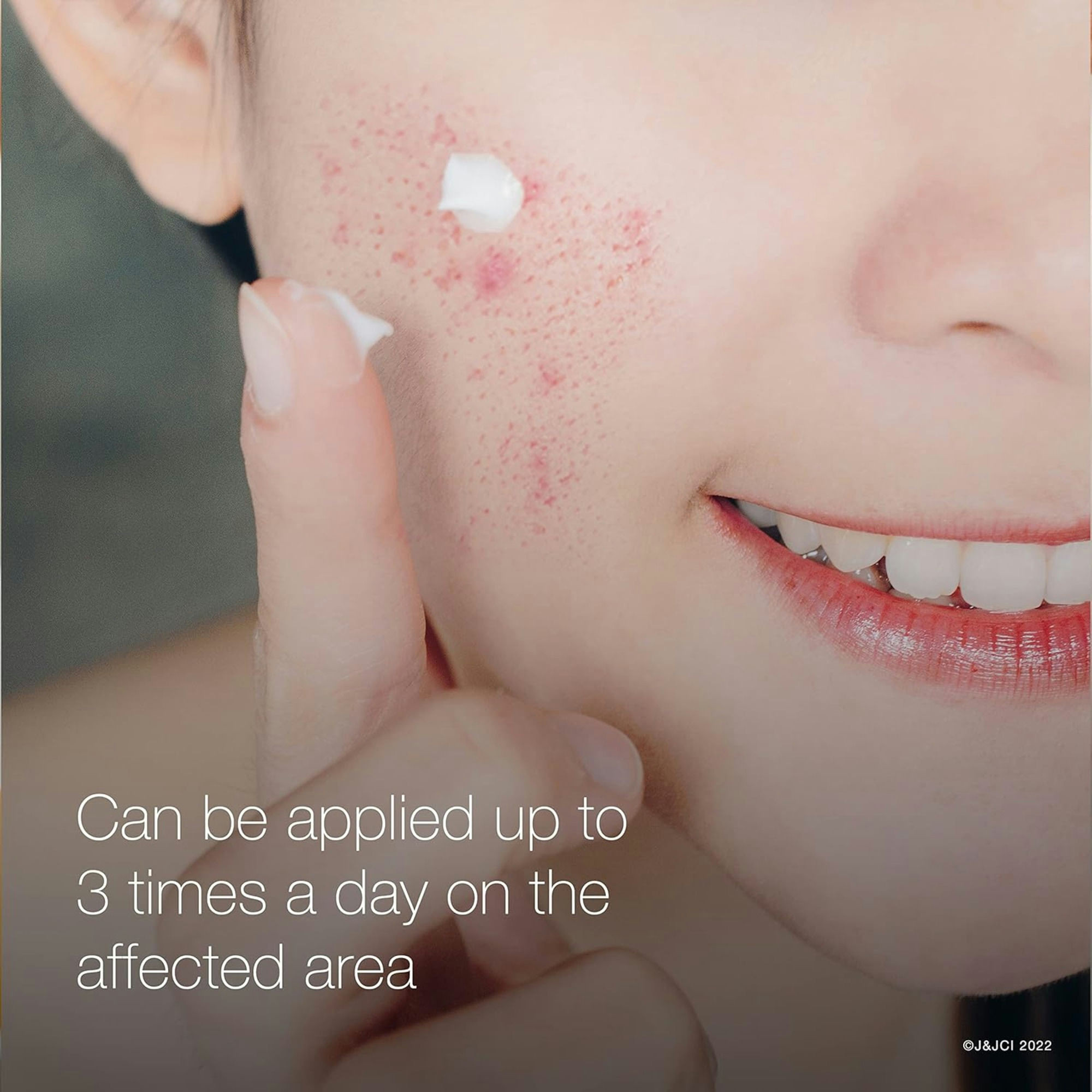 Neutrogena Rapid Clear Stubborn Acne Spot Gel