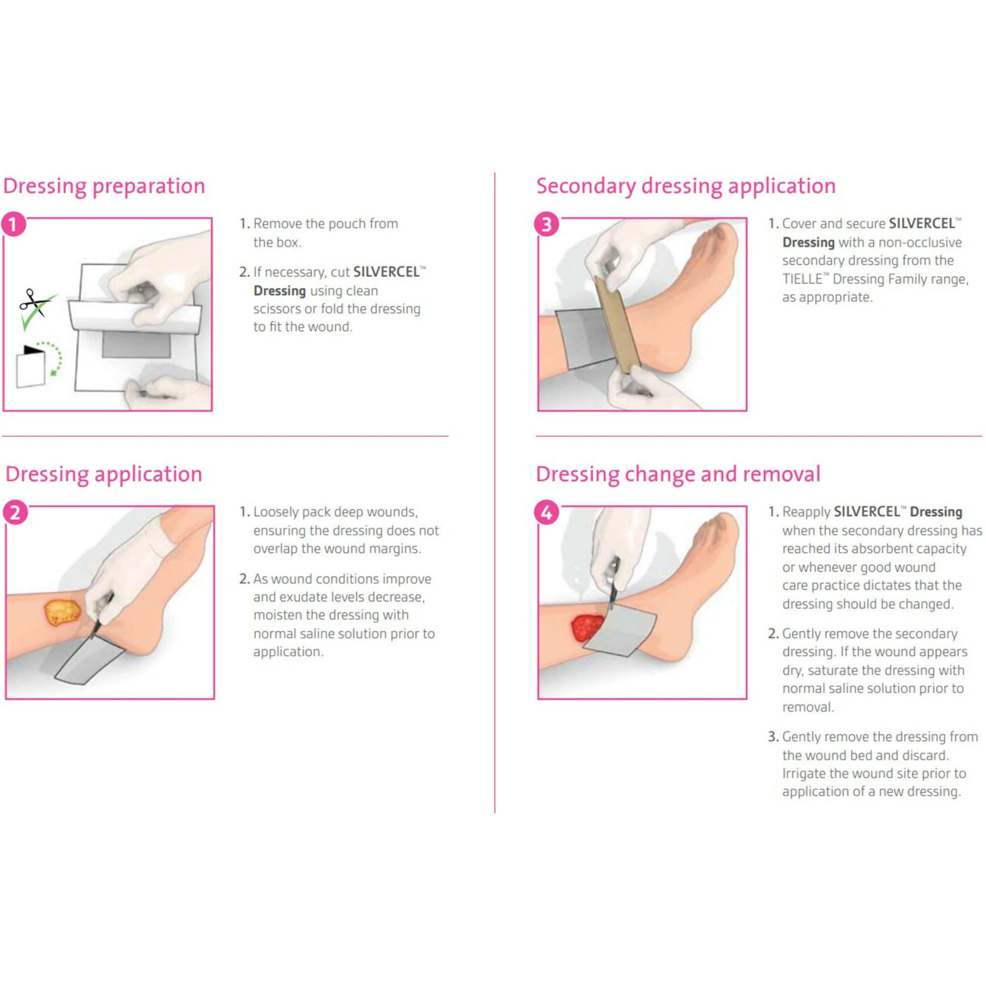 3M Silvercel Non-Adherent Antimicrobial Alginate Dressing