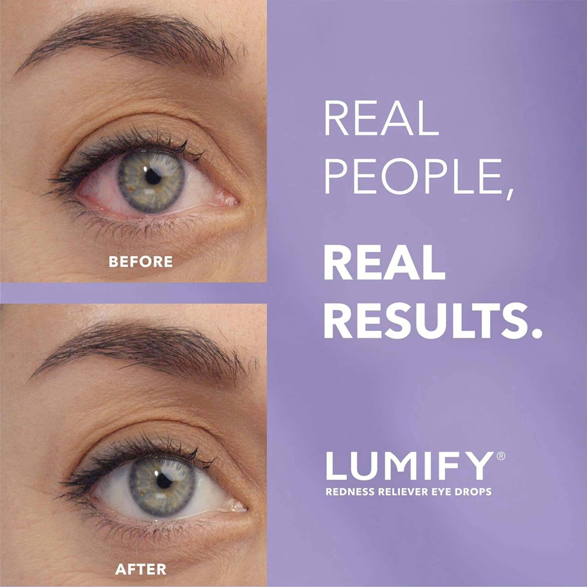 Lumify Redness Reliever Eye Drops