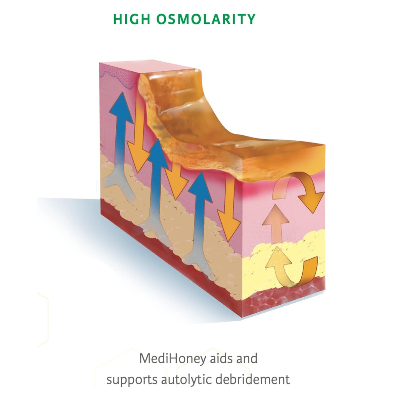 MediHoney Wound and Burn Dressing Gel