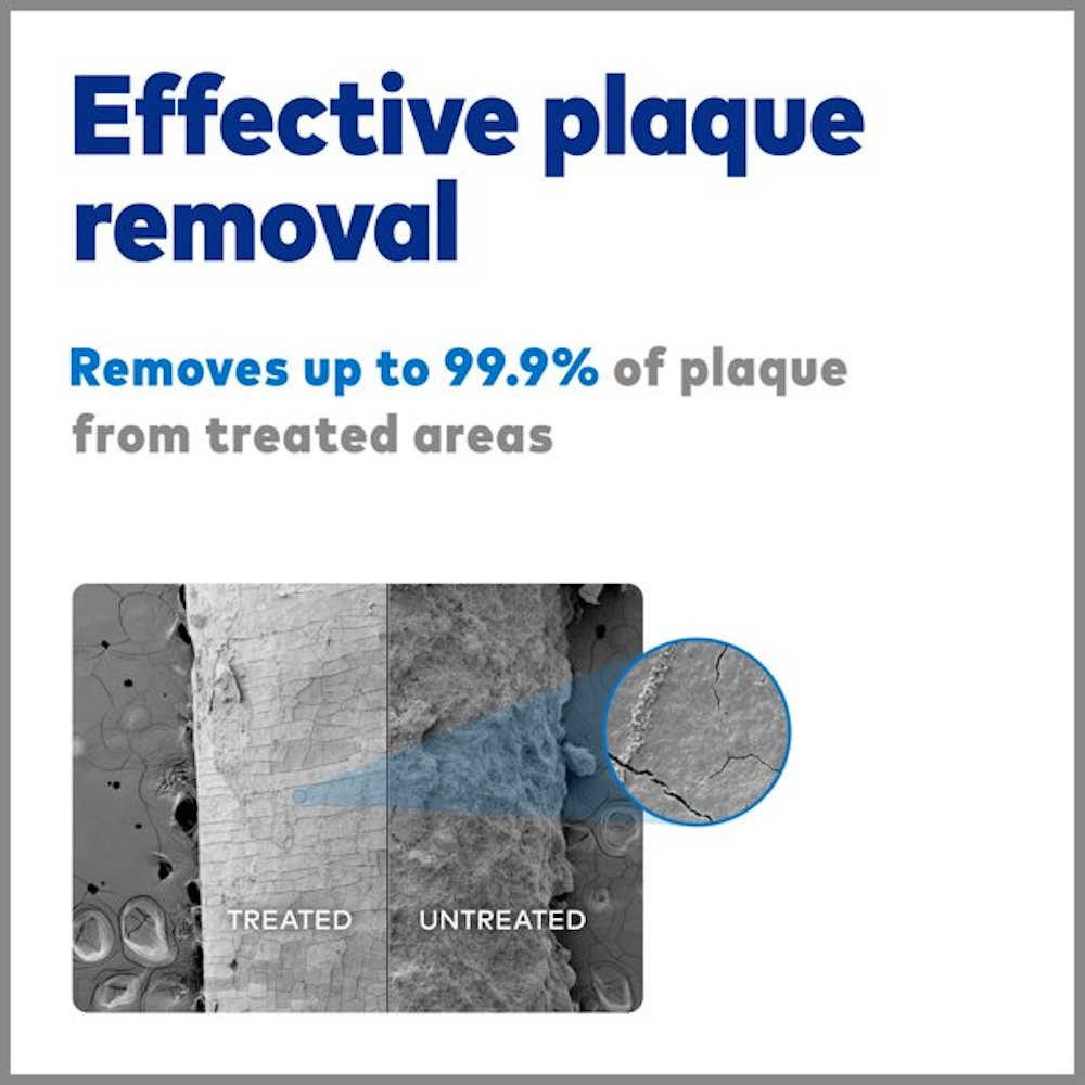 Waterpik Oral Irrigator Water Flosser, Rechargeable