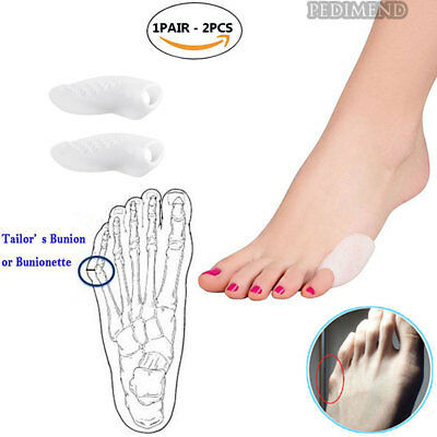 McKesson Tailor's Bunion Shield