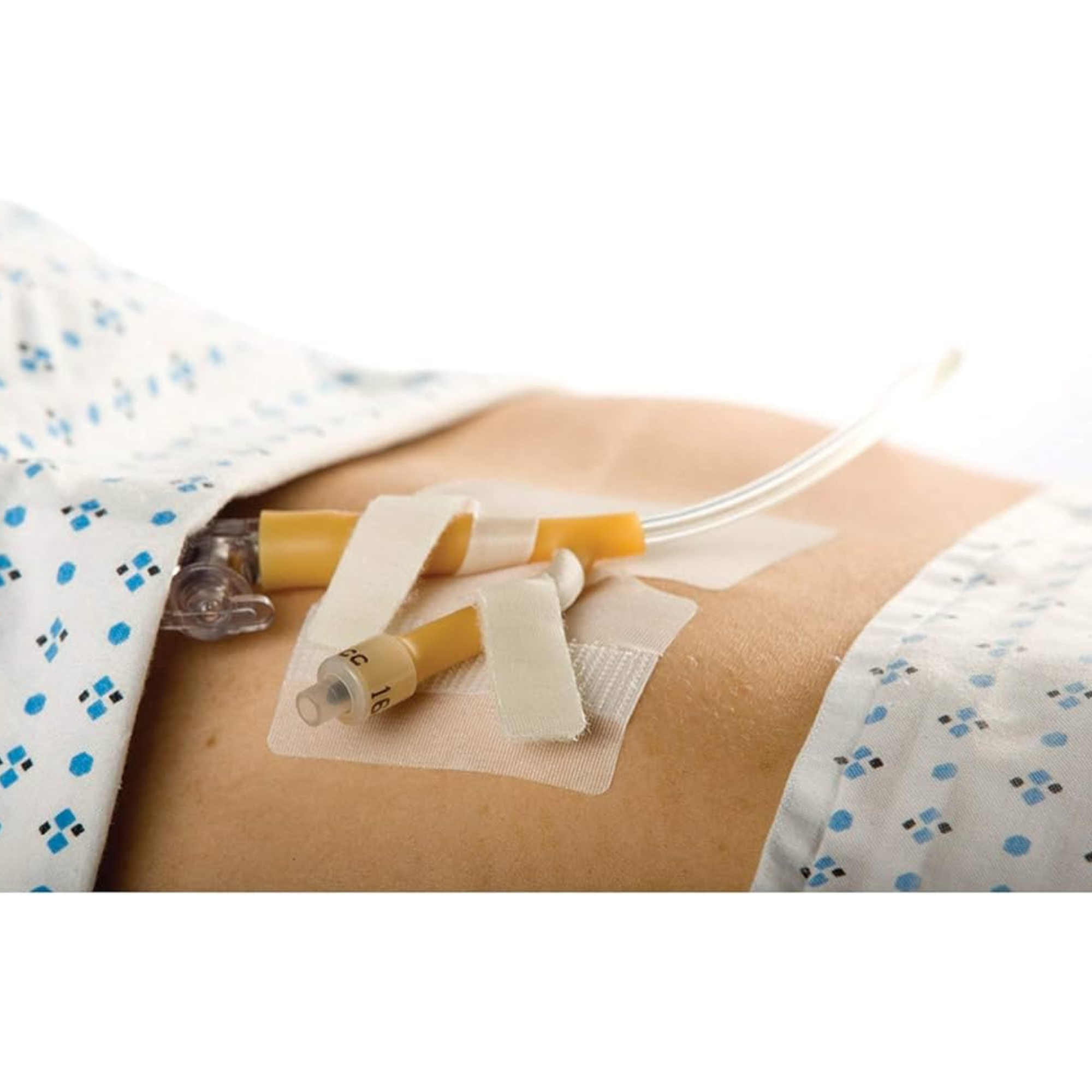 Cath-Secure Dual Tab Catheter Holder