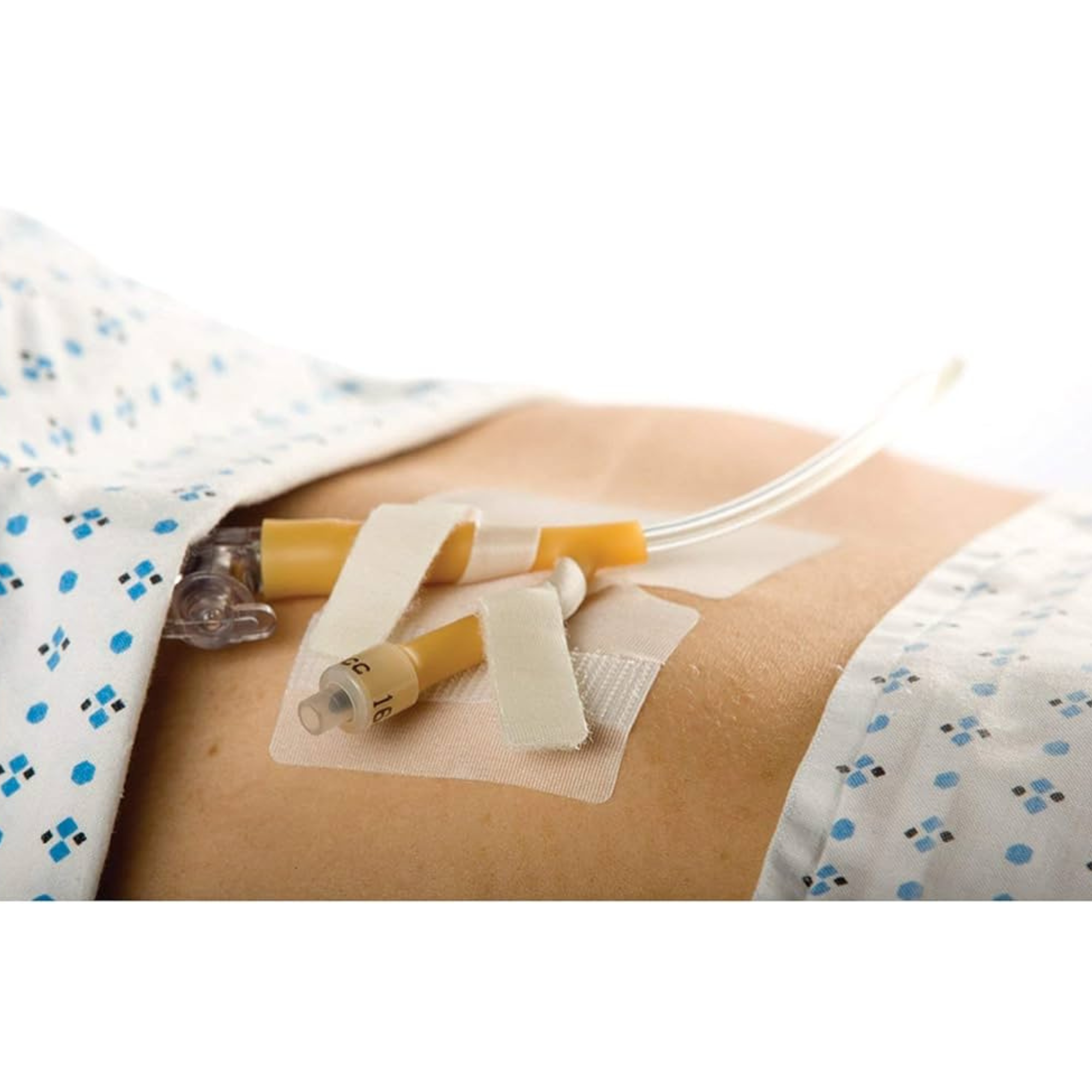 Cath-Secure Dual Tab Catheter Holder, 5445-4, 1 Each