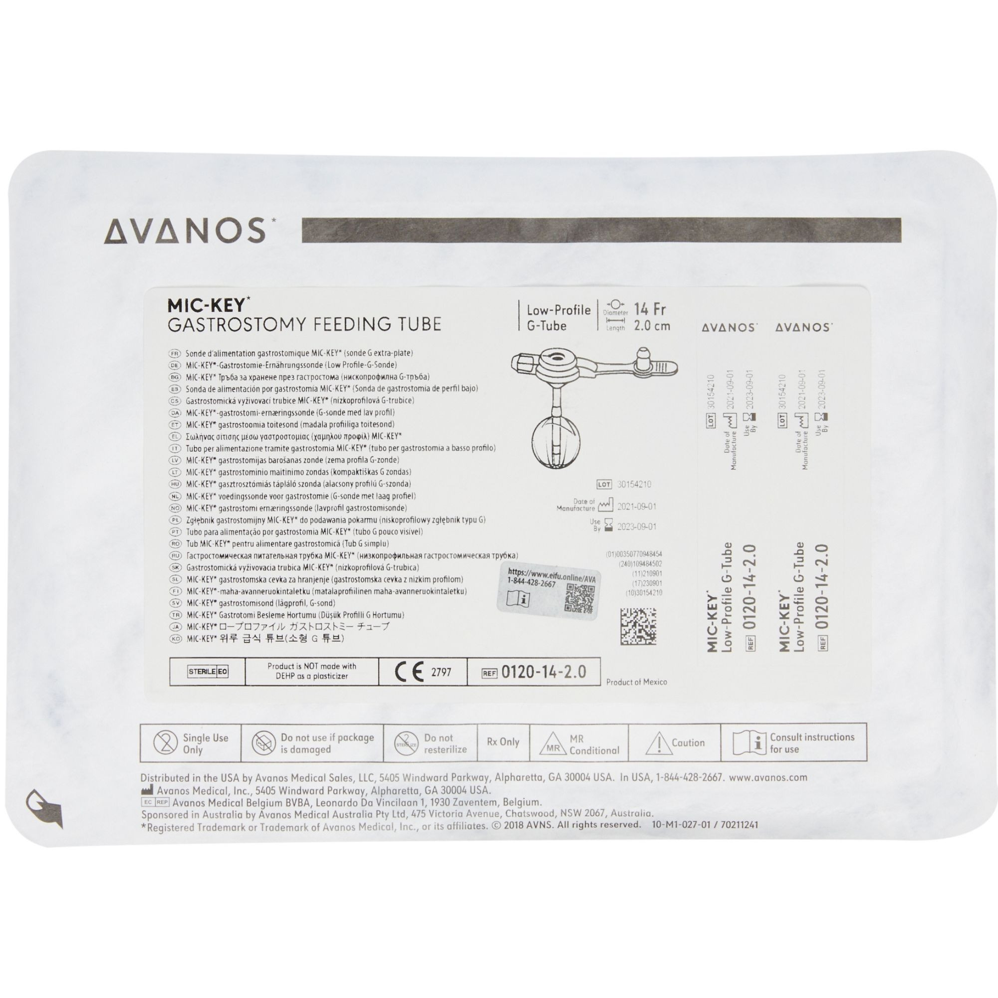 MIC-KEY Low-Profile Gastrostomy Feeding Tube Kit, 14 Fr., 2.0 cm Tube