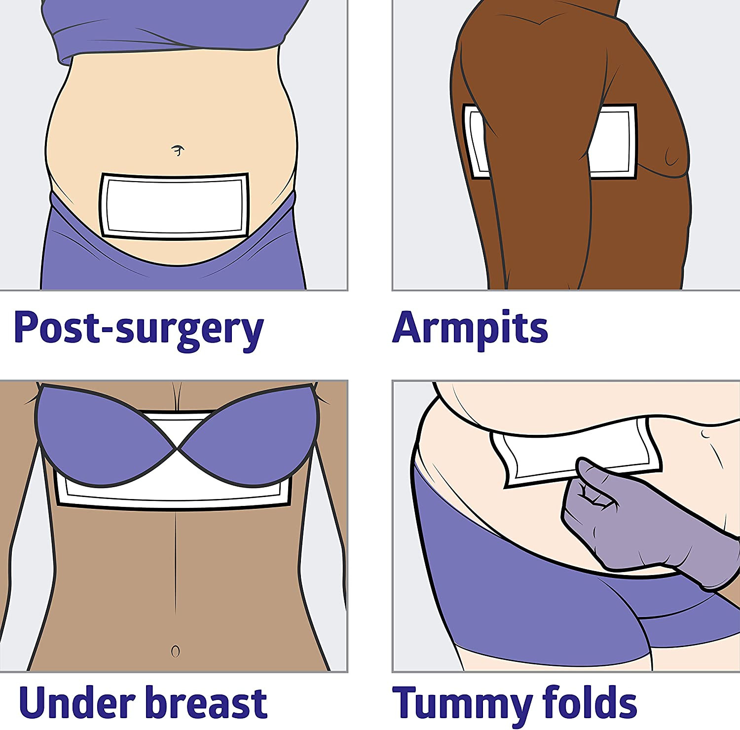 Medline Skinfold Dry Sheets, MSC10614Z, 6" X 14" - Bag of 10