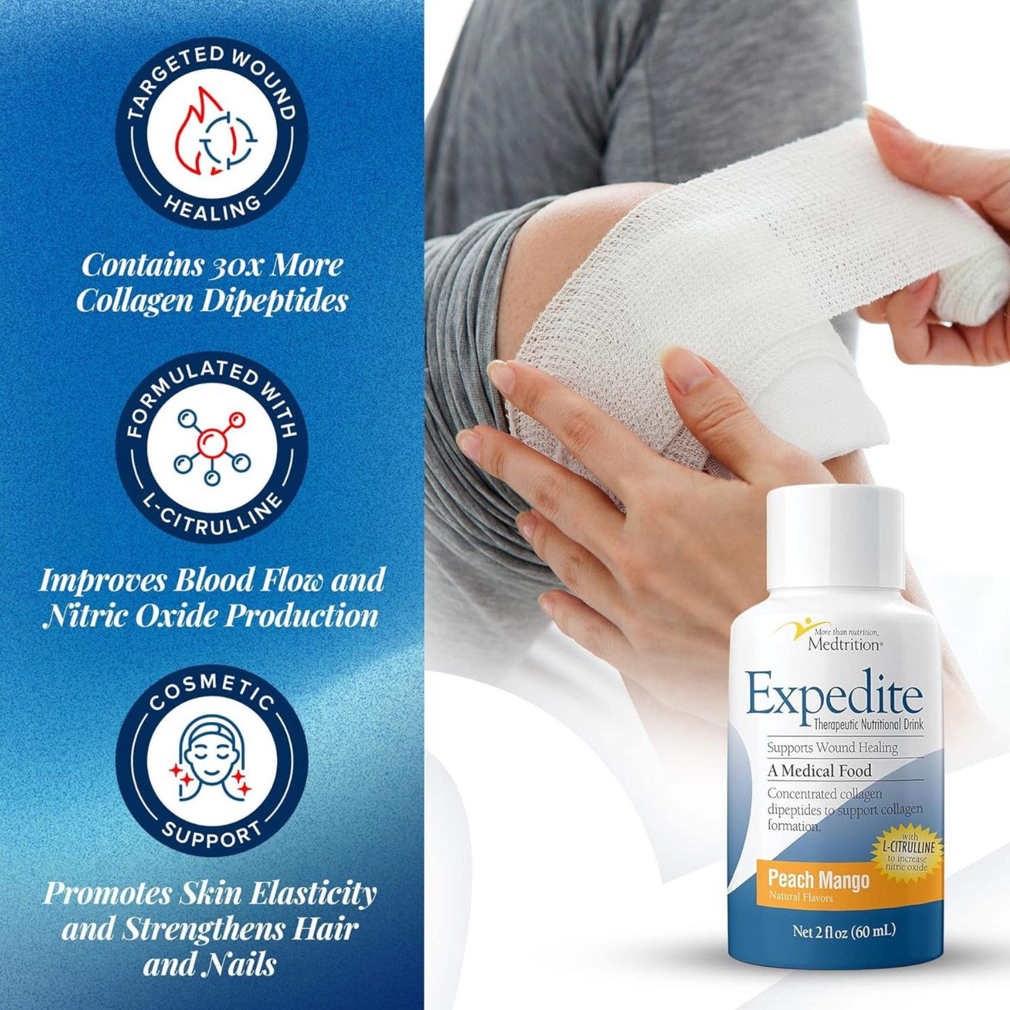 Medtrition Expedite Fast Track Wound Healing Drink, Peach Mango, 2 oz. Bottle, 18800, Peach Mango Flavor - Case of 48