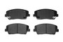 Brake Pads AD2117 - kit contents