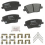Priority 1 Brake Pads CFM2212 - front view
