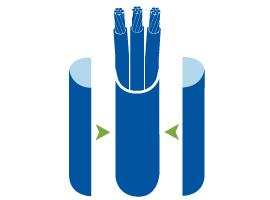 overall-shielding-sample.gif