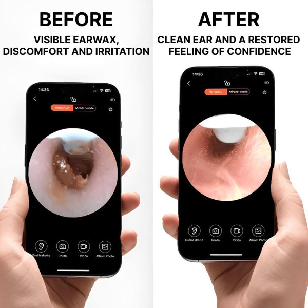 Ear Pick With Camera - Connected Ear Cleaner zaxx