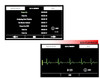 CU Medical iPAD SP2 Automatic External Defibrillator - Packages 