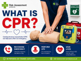 What is CPR?