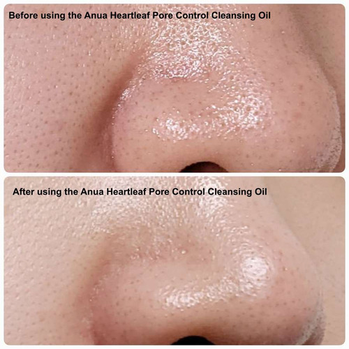 Anua Heartleaf Pore Control Cleansing Oil KBeauty Australia 5-benefits-of-using-a-cleansing-balm-beauty-bay-edited
