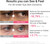 Medicube PDRN Pink Caffeine Collagen Eye Patch 60pcs – Before and After 