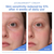 Aestura ATOBARRIER 365 Cream 80 mL - Before & After 4 Weeks