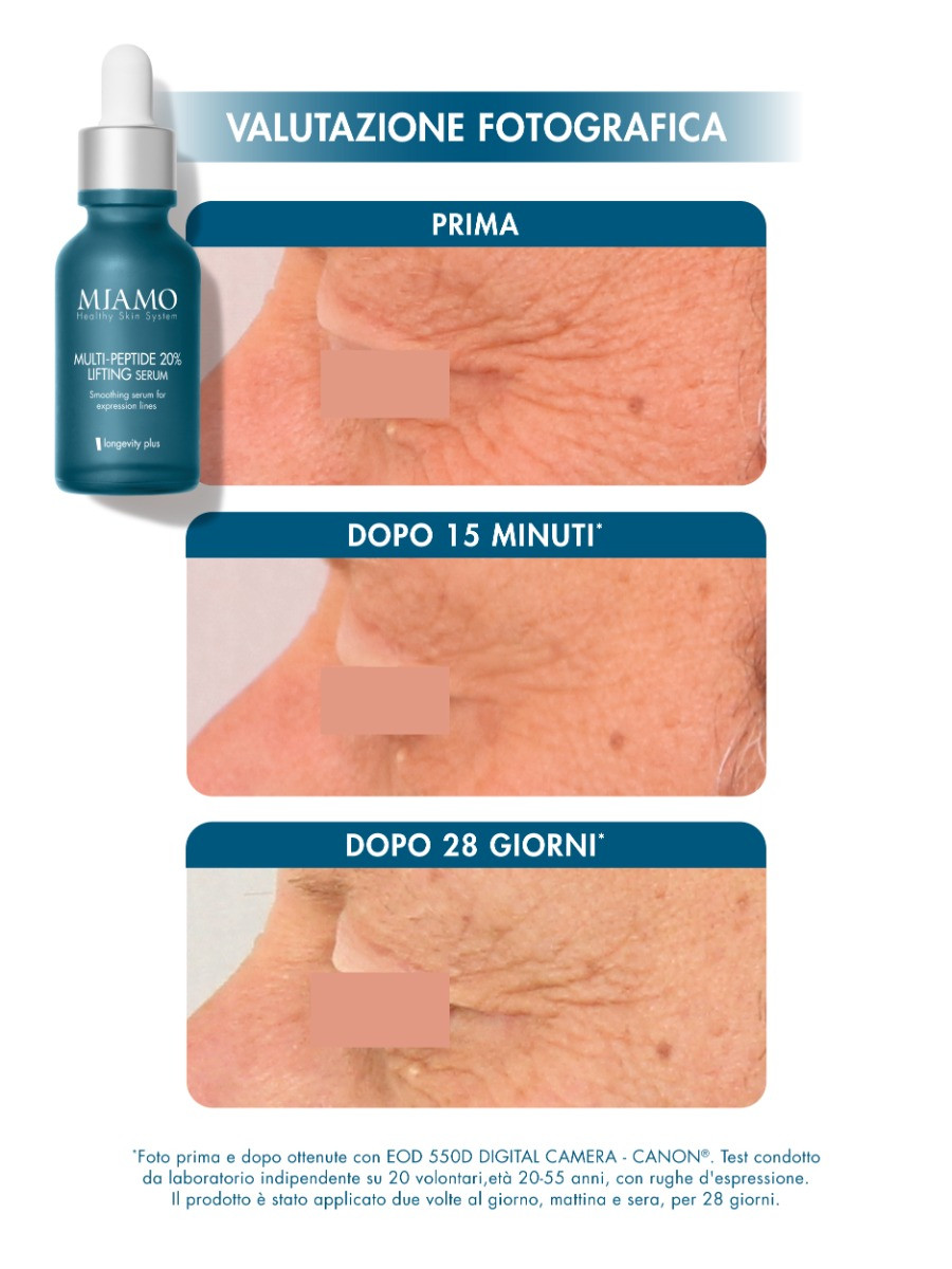 Miamo - Protocollo Lift&Aax Per Le Rughe D'espressione