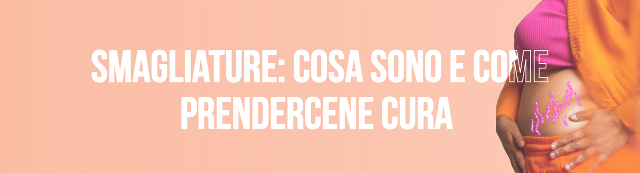 Smagliature: cosa sono, perché compaiono e come prendersene cura tra cambiamenti fisici e gravidanza Smagliature: cosa sono, perché compaiono e come prendersene cura tra cambiamenti fisici e gravidanza